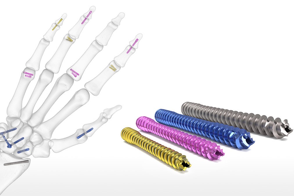 Acumed_Acutrak_3_Headless_Compression_Screw_8473_0.jpg Acumed_Acutrak_3_Headless_Compression_Screw_8473_0.jpg